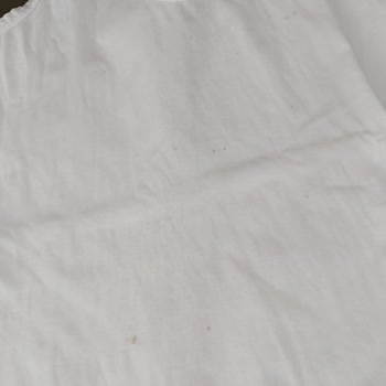 Electrolux Çamaşır Makinesi Lekeleri Ve İlgisiz Müşteri Hizmetleri