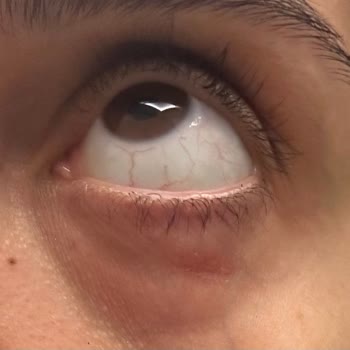 Estee Lauder Ürünleri Cilt Sorunlarına Yol Açtı