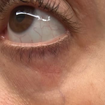 Estee Lauder Ürünleri Cilt Sorunlarına Yol Açtı