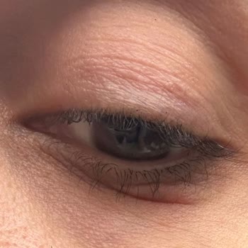 Estee Lauder Ürünleri Cilt Sorunlarına Yol Açtı