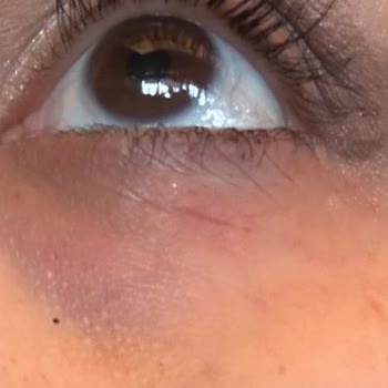 Estee Lauder Ürünleri Cilt Sorunlarına Yol Açtı