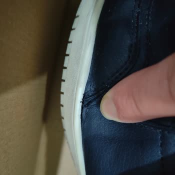 Kısa Sürede Açılan Dikişler Ve Yetersiz İnceleme Süreci