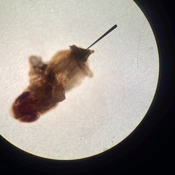 Zühre Ana Detoks Sirkesi İçinde Böcek Şoku: Güvenimiz Sarsıldı