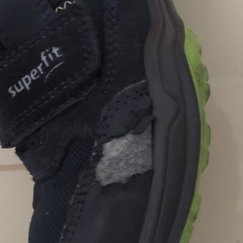 Superfit Bot Deformasyonu Ve İletişim Sorunları