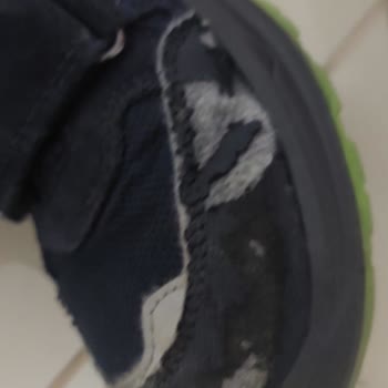 Superfit Bot Deformasyonu Ve İletişim Sorunları