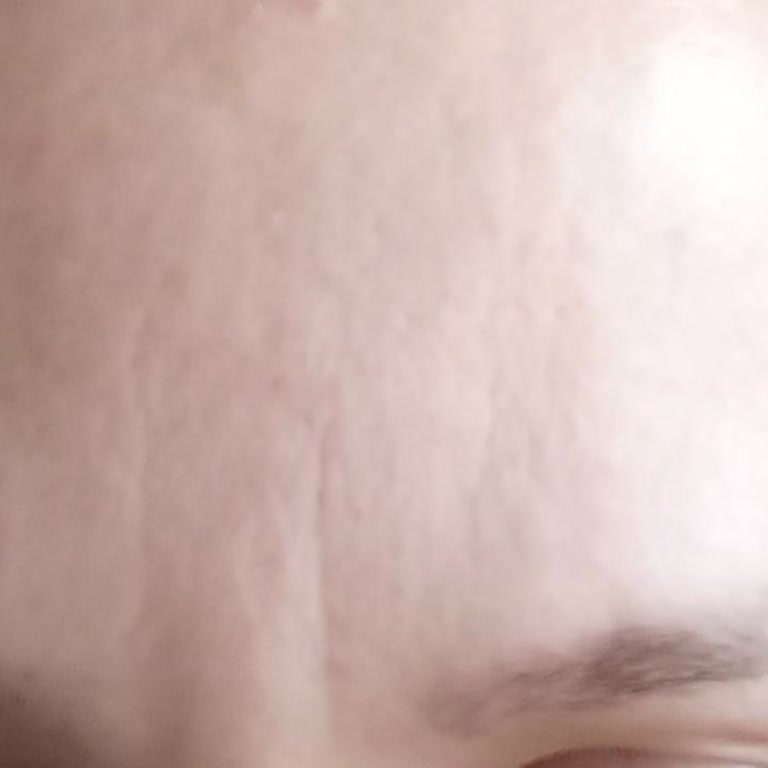 Réve Estetik İzmir Şikayeti