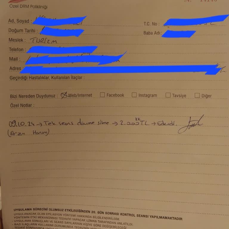 Dövme Sildirme İşleminde Beklenmedik Ücret Artışı