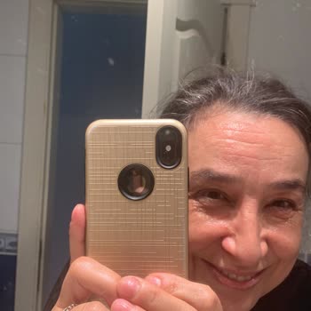 Nivea Makyaj Temizleyici Egzama Yaptı, Zararımı Karşılayın