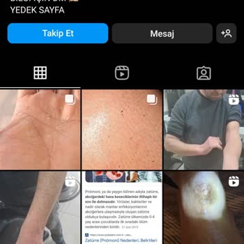 Alerji Tedavisinde Hayal Kırıklığı Ve Engellenme