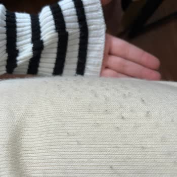 Trendyolmilla Ürününde Hayal Kırıklığı: Tüylenme Sorunu
