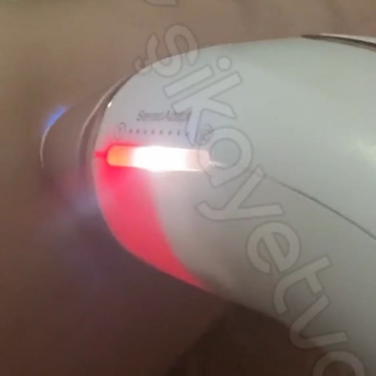 Media Markt'ta Hayal Kırıklığı: Braun Silk Pro 5 Deneyimim