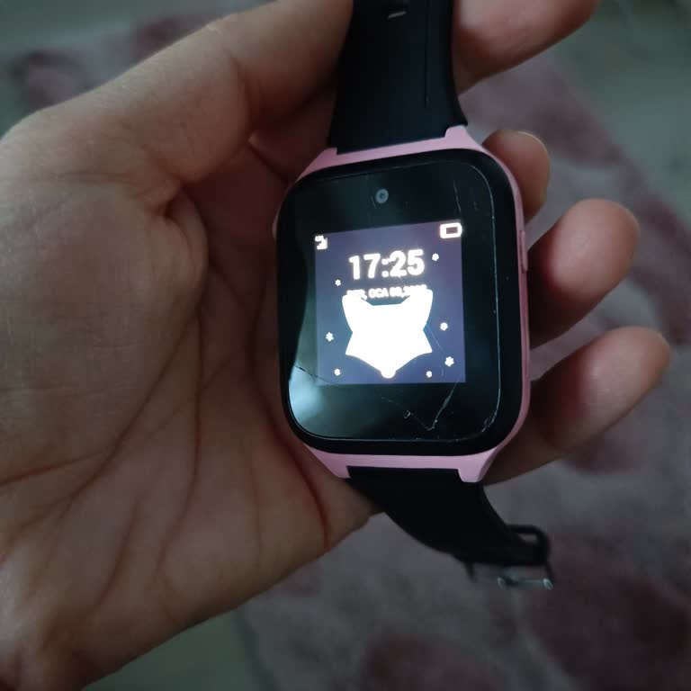 Aşırı Isınan Akıllı Saatle Güvenlik Endişesi