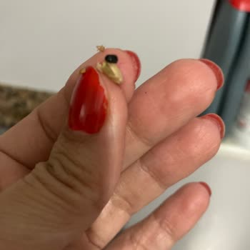 Migros Yeşil Mercimek Skandalı: Böceklerle Dolu!