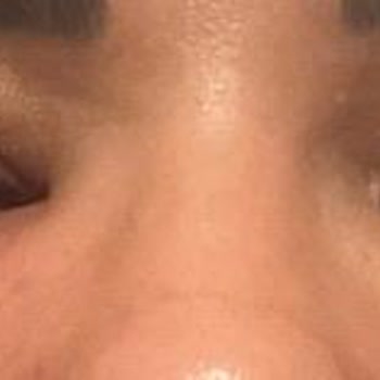 Medica Derma Yanıltıcı Hizmet Ve Sağlık Sorunlarıyla Karşılaştım