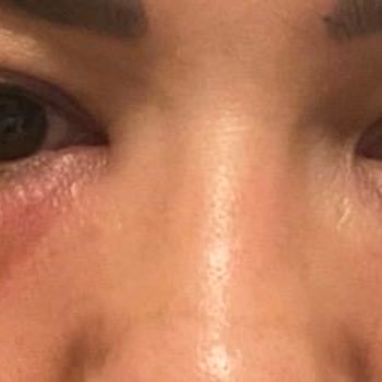 Medica Derma Yanıltıcı Hizmet Ve Sağlık Sorunlarıyla Karşılaştım