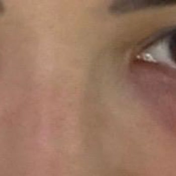 Medica Derma Yanıltıcı Hizmet Ve Sağlık Sorunlarıyla Karşılaştım