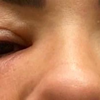 Medica Derma Yanıltıcı Hizmet Ve Sağlık Sorunlarıyla Karşılaştım