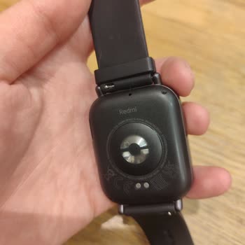 Xiaomi Watch 5 Active: Alerji Ve Hayal Kırıklığı