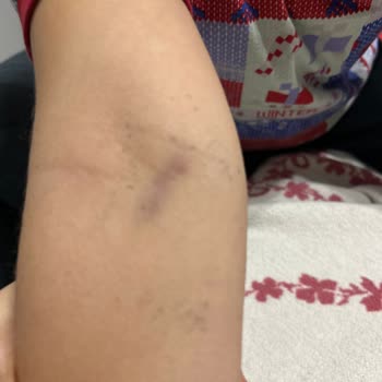 Özel Hastanede Hayal Kırıklığı: İlgisizlik Ve Kötü Muamele