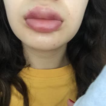 Yanlış İsim Ve Sağlık Sorunlarıyla Karşılaştım