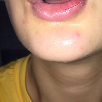 Yanlış İsim Ve Sağlık Sorunlarıyla Karşılaştım