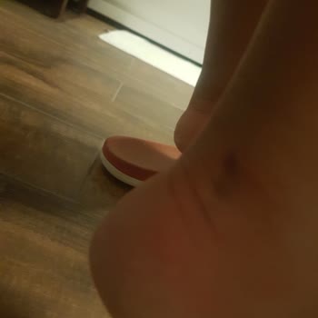 Ayakkabılarım Ayağımı Yaralıyor, İade Kabul Edilmiyor