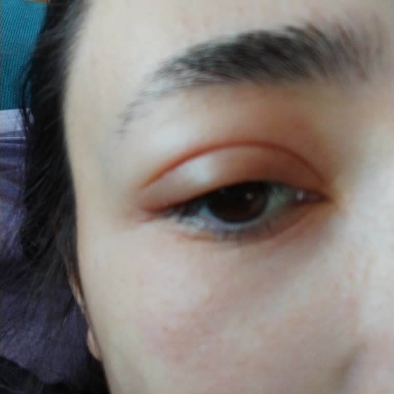 Hassas Ciltler İçin Uygun Olmayan Yüz Temizleme Suyu