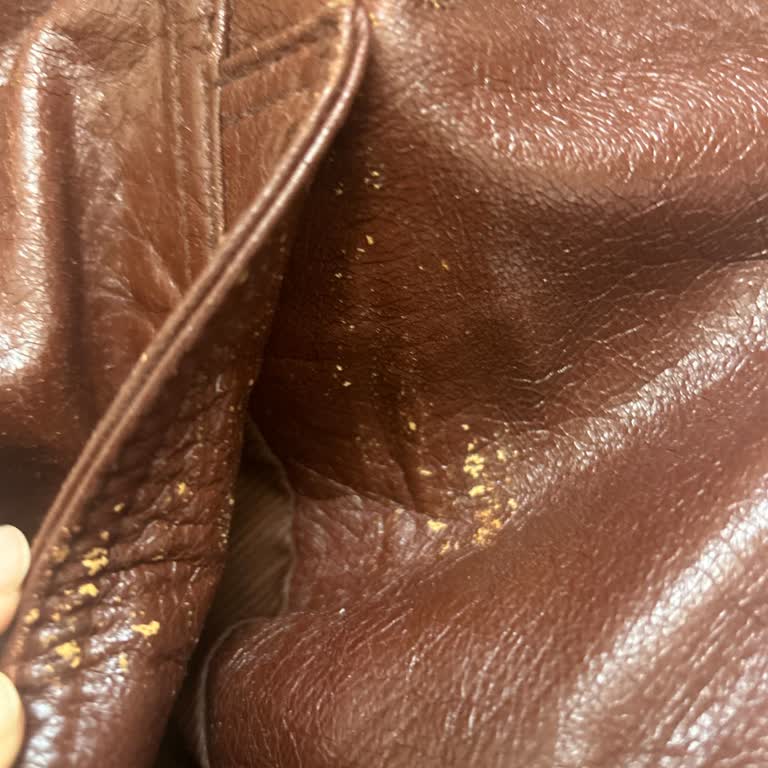 Dökülen Deri Ceket Ve Ulaşılamayan Müşteri Hizmetleri