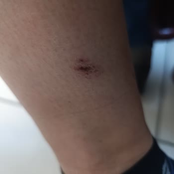 Deichmann Bot Fermuar Sorunu Ve Müşteri Hizmetleri Yanıtı