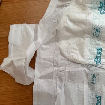 Bezlerin Bağlama Kısımlarındaki Üretim Hatası