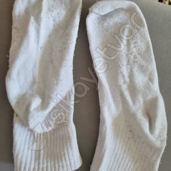 Beko Çamaşır Makinesi: Yıpranan Giysiler Ve Çözülmeyen Sorunlar