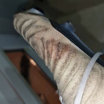 Kramponlar Ayağımı Yara Yapıyor, Değişim Talep Ediyorum