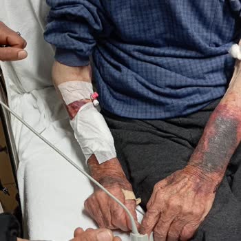 Hastanede Yoğun Bakımda Kötüleşen Durum