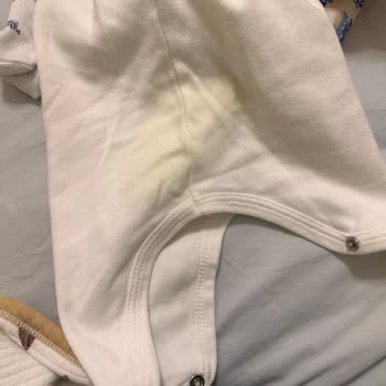 Molfix Bebek Bezi Sızıntı Sorunu Ve Güven Kaybı