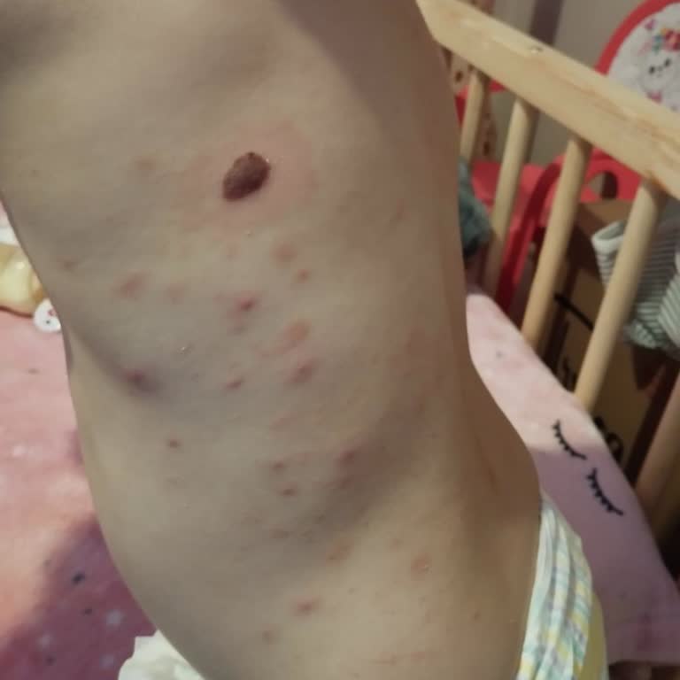 Randevu Sistemi Sorunu Ve Endişe Dolu Bekleyiş