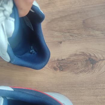 Adidas Ayakkabıda Erken Aşınma Ve Deformasyon Sorunu