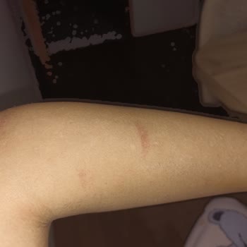 Nouvelle Vie Güzellik Merkezi İlgi Alaka Sıfır