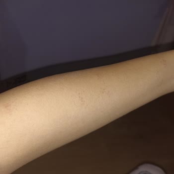 Nouvelle Vie Güzellik Merkezi İlgi Alaka Sıfır