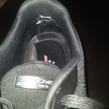 Skechers Ayakkabılar Ayaklarımı Yara Ediyor