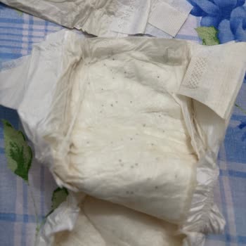 Bebek Bezinde Şok Edici Siyah Noktalar