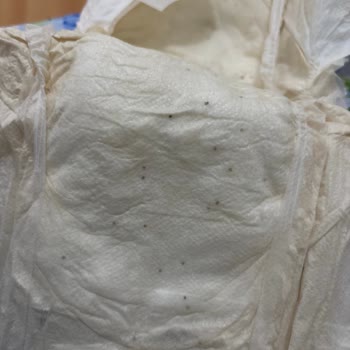 Bebek Bezinde Şok Edici Siyah Noktalar