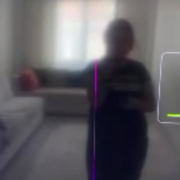 Samsung Televizyon Kurulum Sonrası Çizik Sorunu