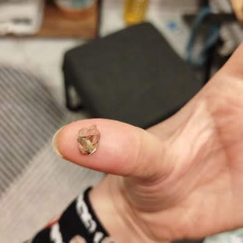 Köftede Taş Skandalı: Çocuğumun Sağlığı Tehlikede!