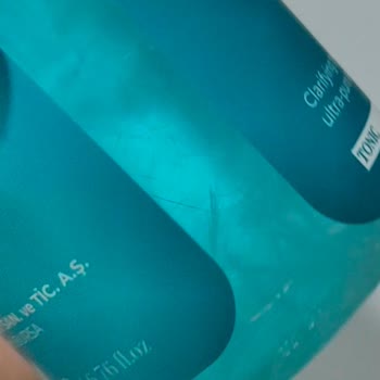 SHE Vec Toniği Cildimde Ağrılı Sivilceler Yaptı