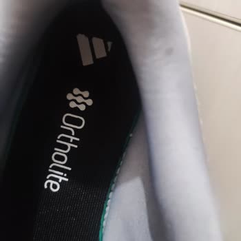 Adidas Ayakkabıda Beklenmedik Deformasyon Ve Hayal Kırıklığı