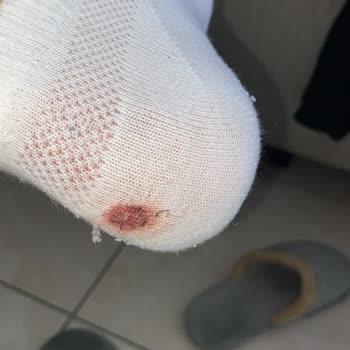 FLO'dan Aldığım Ayakkabı Ayaklarımı Kanatıyor!