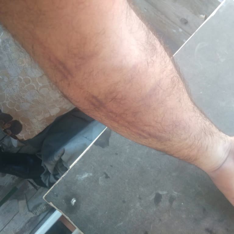 Türk Kızılay Kızılay Kan Bağışında Yaşanan Talihsizlik!