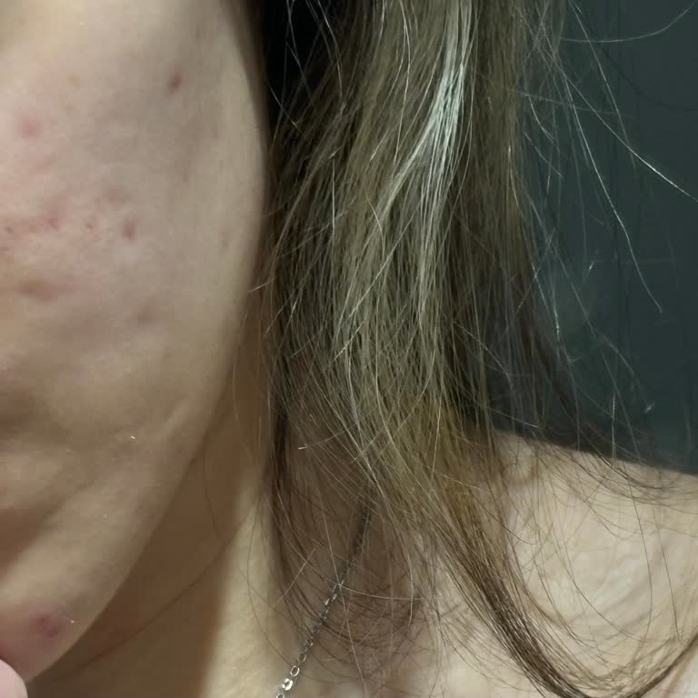 Dr. Rukiye Kaymaz Tedavi Süreci Ve Gizli Maliyetler!