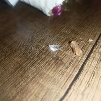 Çiğköfte İçinden Cam Çıktı, Sağlığım Tehlikede