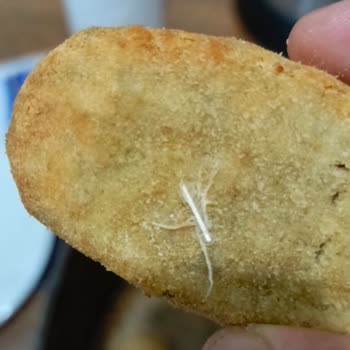 Erpiliç Kadınbudu Köfteden Çıkan Tüylü Tavuk Kanadı Şoku